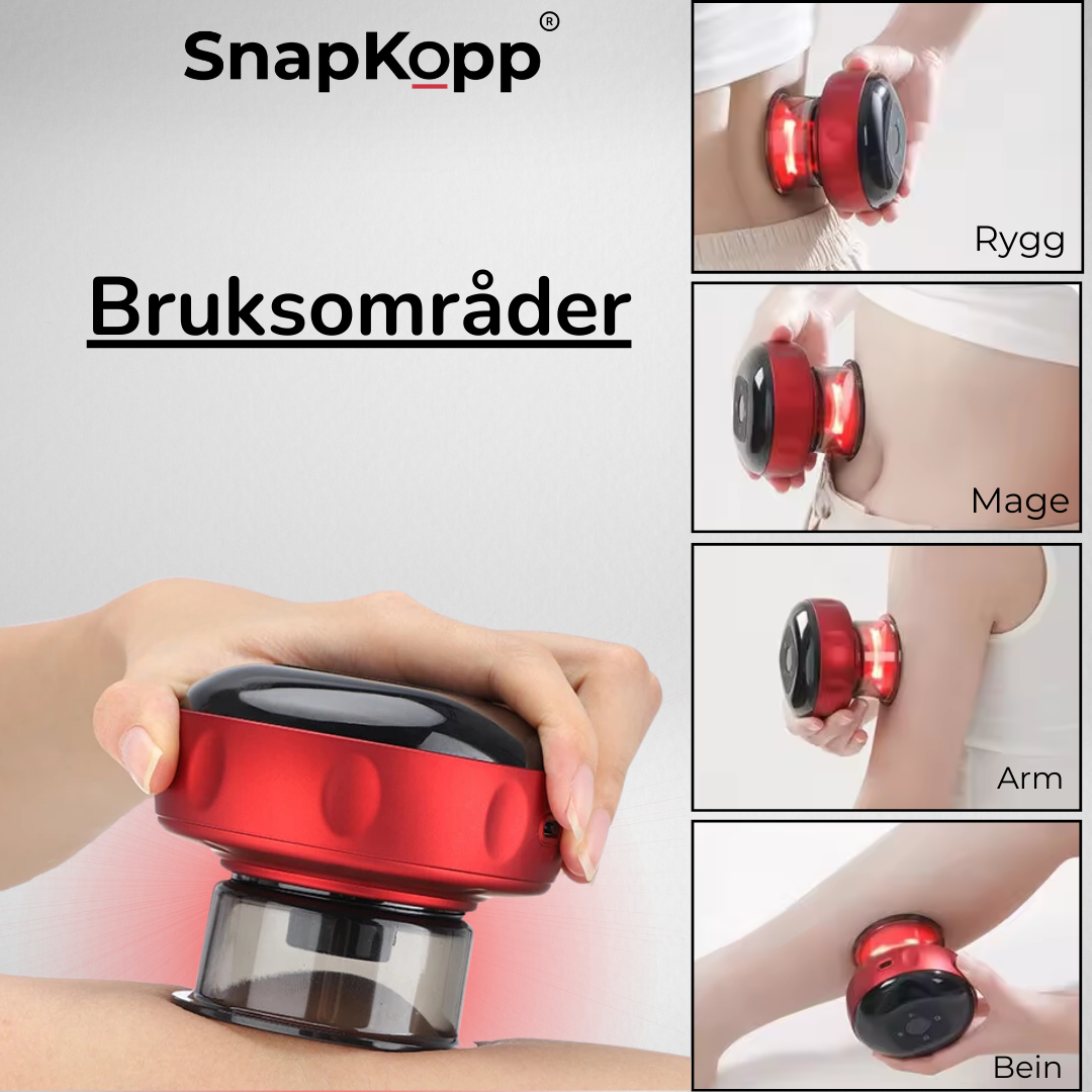 SnapKopp